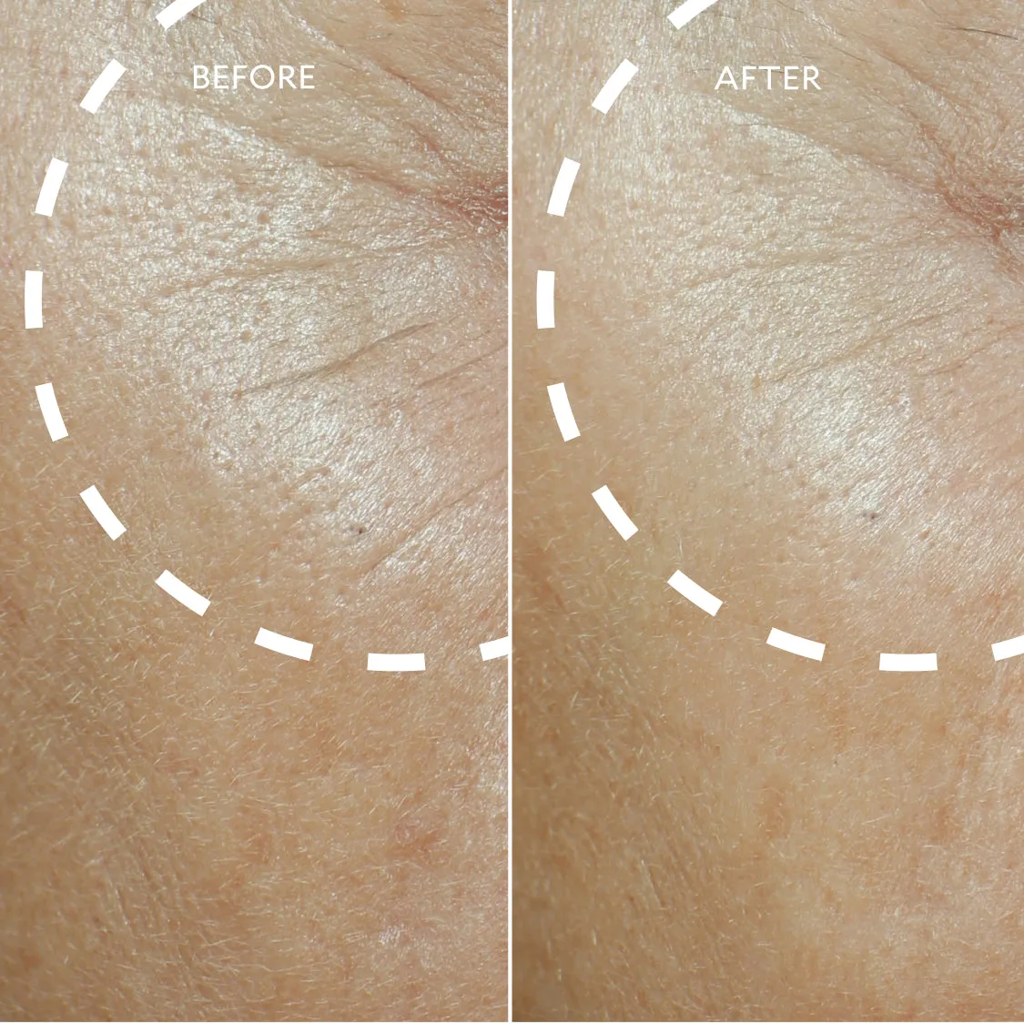 Defi Lift™ Active Firming Serum