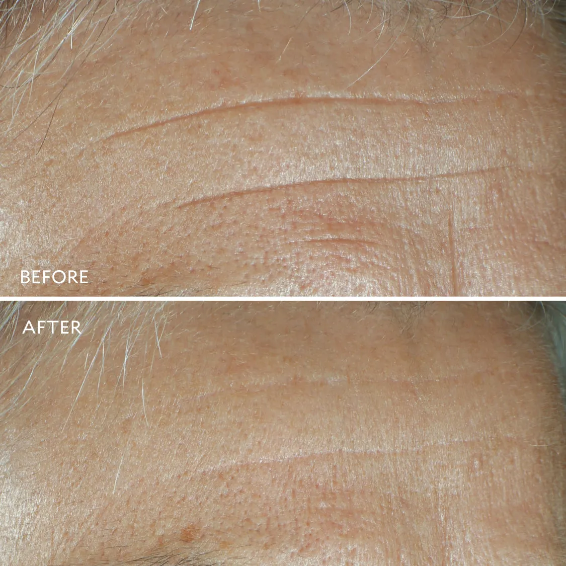 Defi Lift™ Active Firming Serum