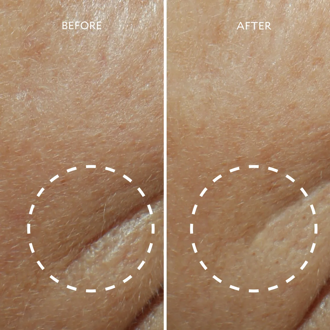 Defi Lift™ Active Firming Serum