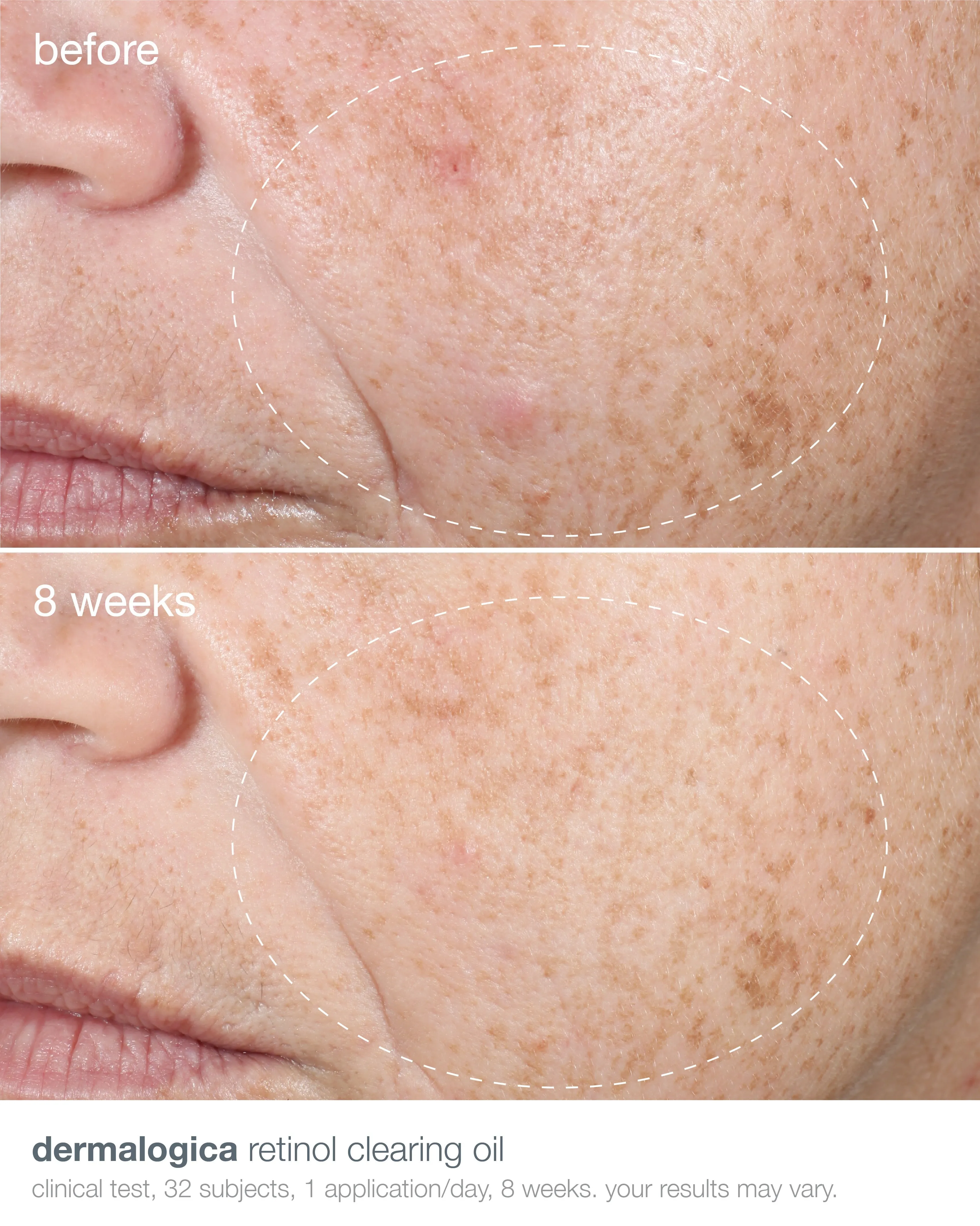 Dermalogica Active Clearing Retinol Clearing Oil