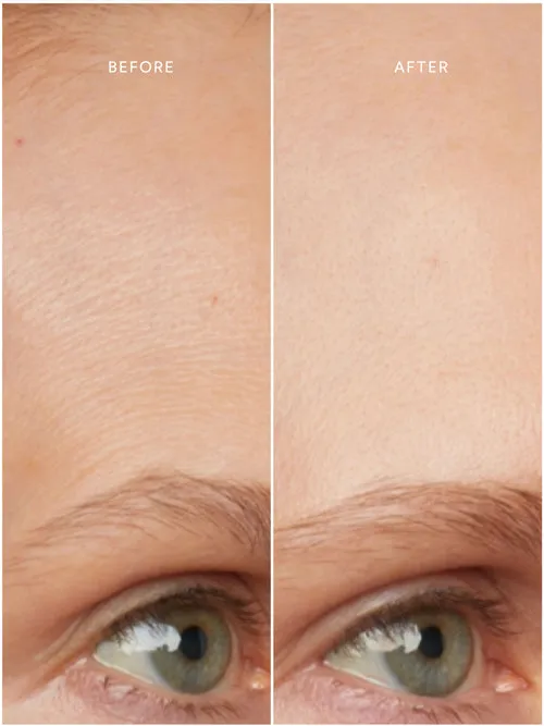 Renew Chebula Active Serum
